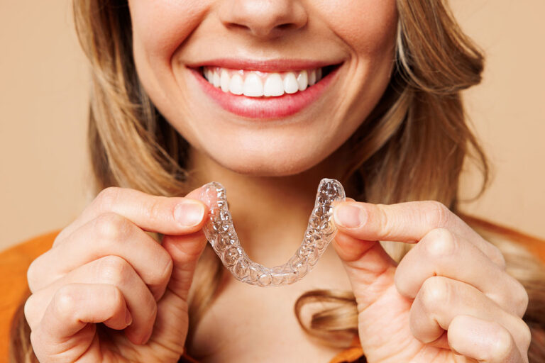 Clear Aligners vs Traditional Braces: Which Is Better for Adults?