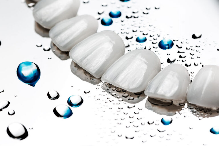 The Dental Symphony | Are Dental Veneers Right for You? A Complete Guide to Transforming Your Smile