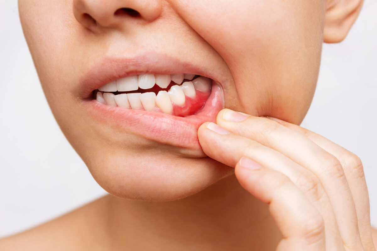The Dental Symphony | Understanding Gum Disease and Why Early Treatment Matters The Dental Symphony | Understanding Gum Disease and Why Early Treatment Matters