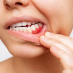 The Dental Symphony | Understanding Gum Disease and Why Early Treatment Matters