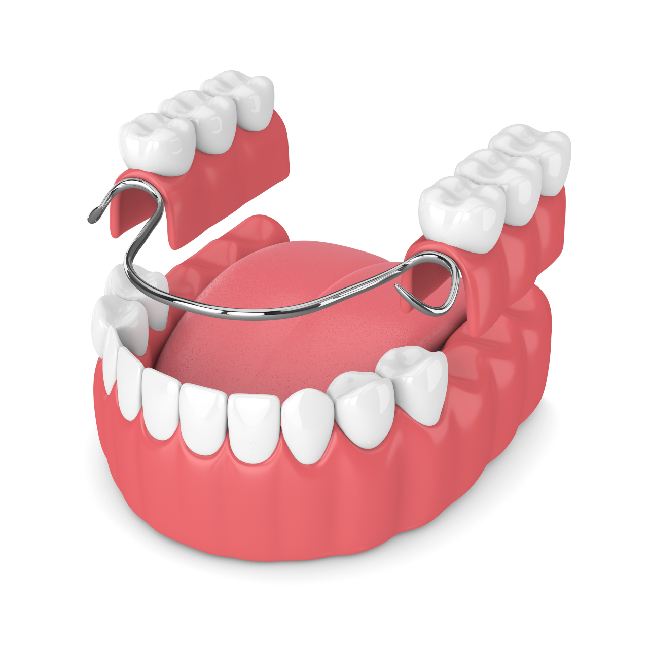 The Dental Symphony | Dentures in Algonquin, IL: What to Expect When Replacing Multiple Missing Teeth