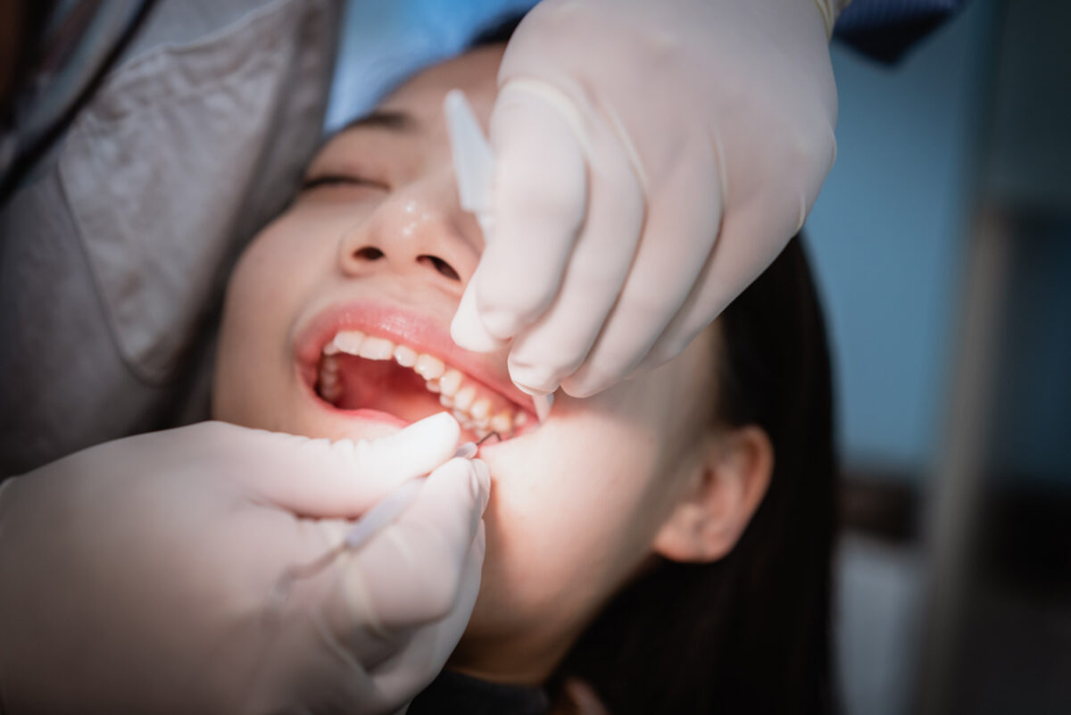 The Dental Symphony | Tooth-Colored Fillings in Algonquin, IL: Why Treating Cavities Early Matters The Dental Symphony | Tooth-Colored Fillings in Algonquin, IL: Why Treating Cavities Early Matters